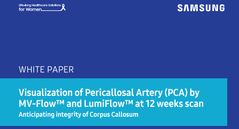 Fetal brain ultrasound with MV-Flow™ and LumiFlow™ for early pericallosal artery visualization