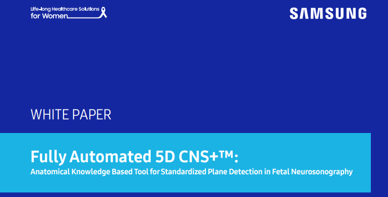White paper on fetal brain ultrasound using Fully Automated 5D CNS+ for standardized plane detection