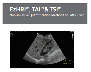 Report on ultrasound-based quantification methods for fatty liver diagnosis using EzHRI™, TAI™, and TSI™