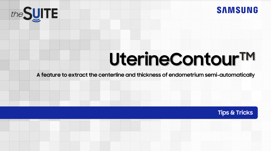 Tips & Tricks on UterineContour™ technology for uterine anomaly classification and endometrium thickness measurement with HERA W10