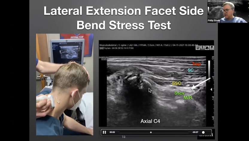 Webinar on suboccipital ultrasound for occipital nerve entrapment assessment
