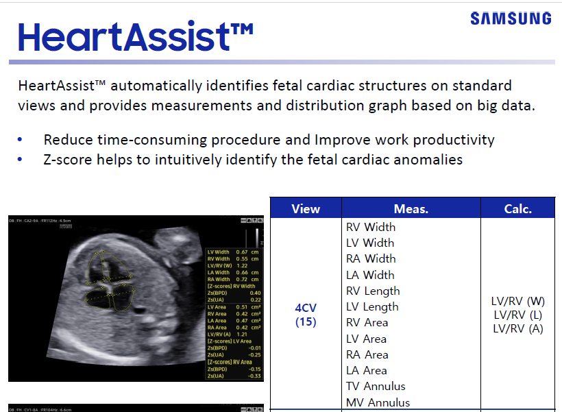 Quick overview of HeartAssist™ for fetal echocardiography using the HERA W10 Elite