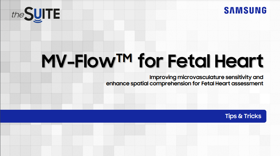 Tips & Tricks on MV-Flow™ technology for fetal heart ultrasound and microvasculature imaging with HERA W10