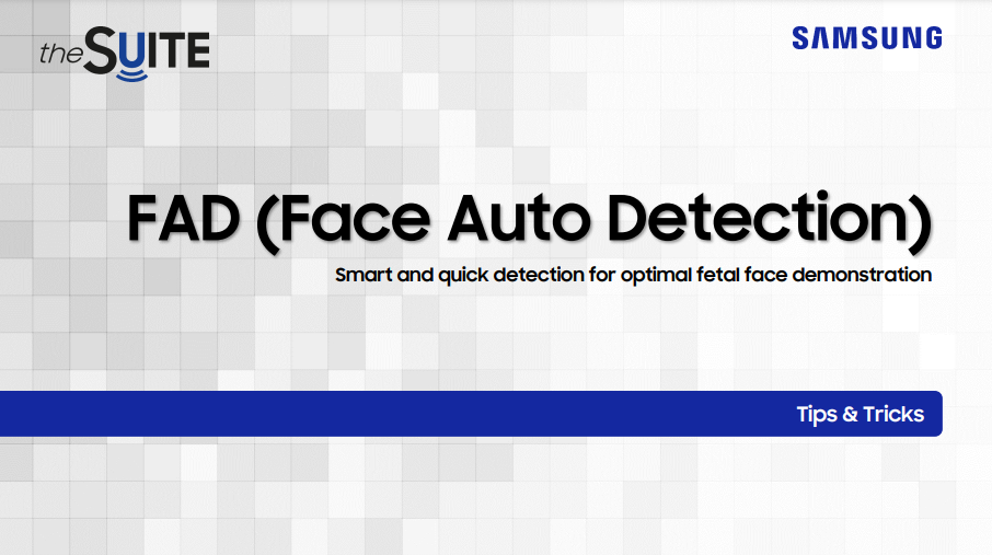 Tips & Tricks on FAD technology for fetal face visualization and efficient 3D ultrasound workflow with HERA W10