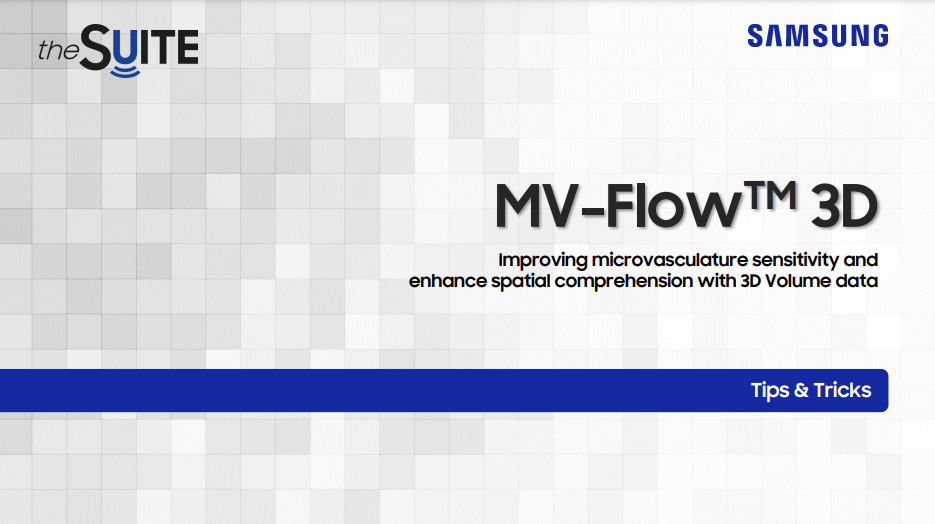 Tips & Tricks on MV-Flow™ 3D technology for 3D vascular visualization, fetal circulation, and fetal brain ultrasound using HERA W10