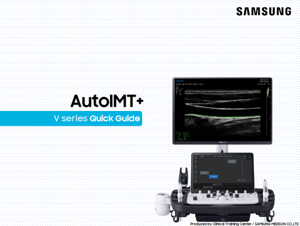 Quick guide on using AutoIMT+ for carotid artery ultrasound and IMT measurement on the V8, V7, V6 ultrasound systems
