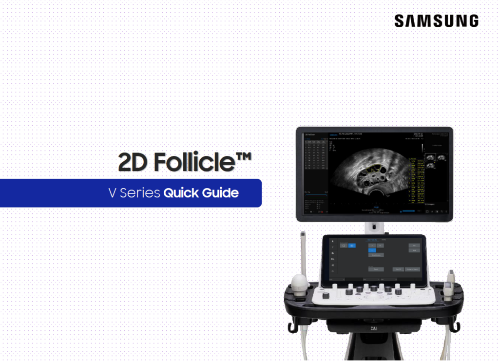 Quick guide on 2D Follicle™ for ovary ultrasound and follicle measurement on the Samsung V8, V7, and V6 ultrasound systems