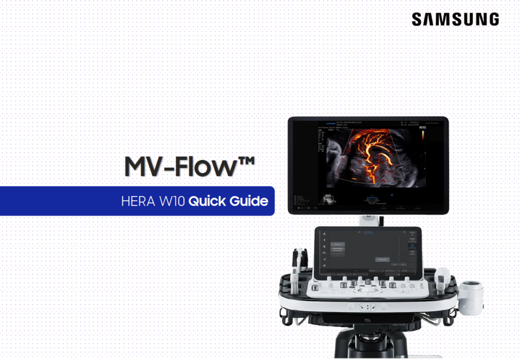 Quick Guide on how to use MV-Flow™ for microvascular ultrasound on the HERA W10