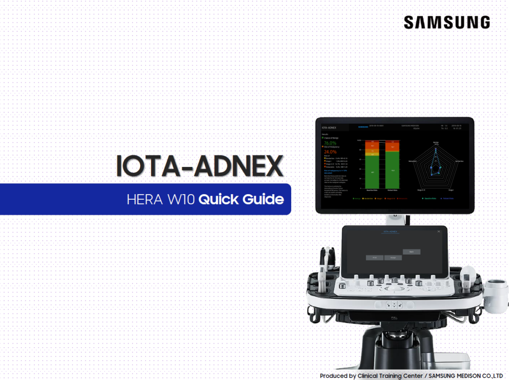 Quick Guide on how to use IOTA-ADNEX for ovarian tumor and adnexal mass evaluation on the HERA W10