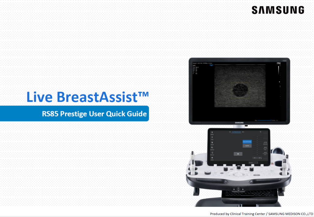 Quick guide on using Live BreastAssist™ for breast ultrasound and real-time lesion detection on the RS85 Prestige system