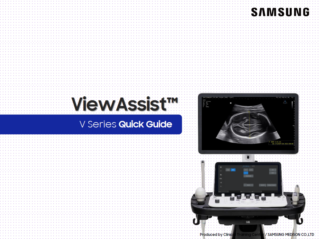 Ultrasound guide on ViewAssist™ for fetal growth assessment using V series ultrasound systems