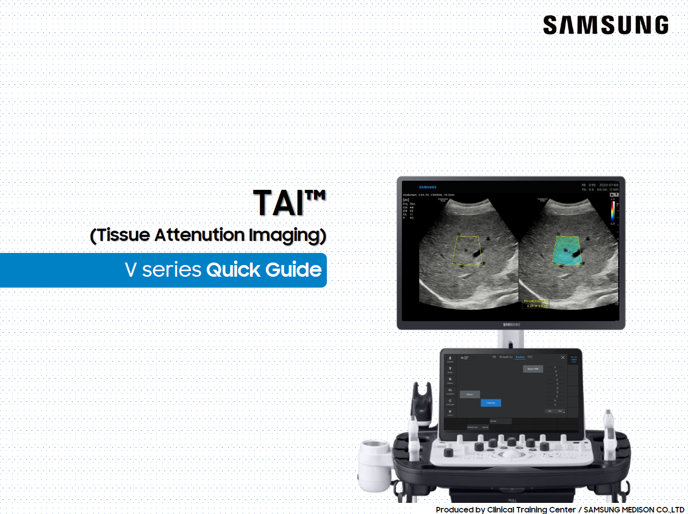Quick guide on TSI™ for liver ultrasound and quantitative scatter imaging on the V series ultrasound machines.