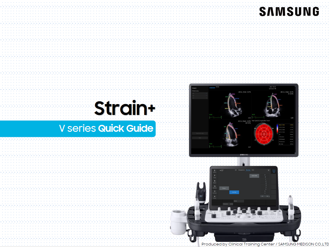 Quick Guide on Strain+ for Cardiac Strain Imaging on V Series
