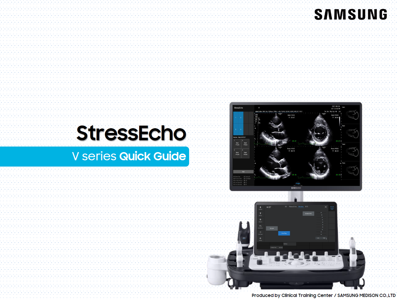 Quick Guide on StressEcho for Cardiac Ultrasound