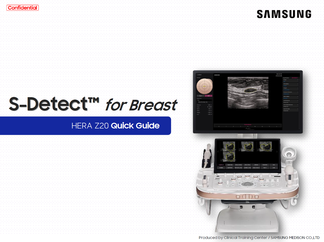 Quick Guide on S-Detect™ for breast ultrasound and BI-RADS classification using HERA Z20