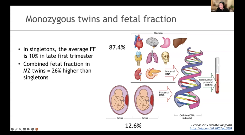 Webinar on NIPT in twin and multiple pregnancies with focus on screening accuracy and clinical interpretation