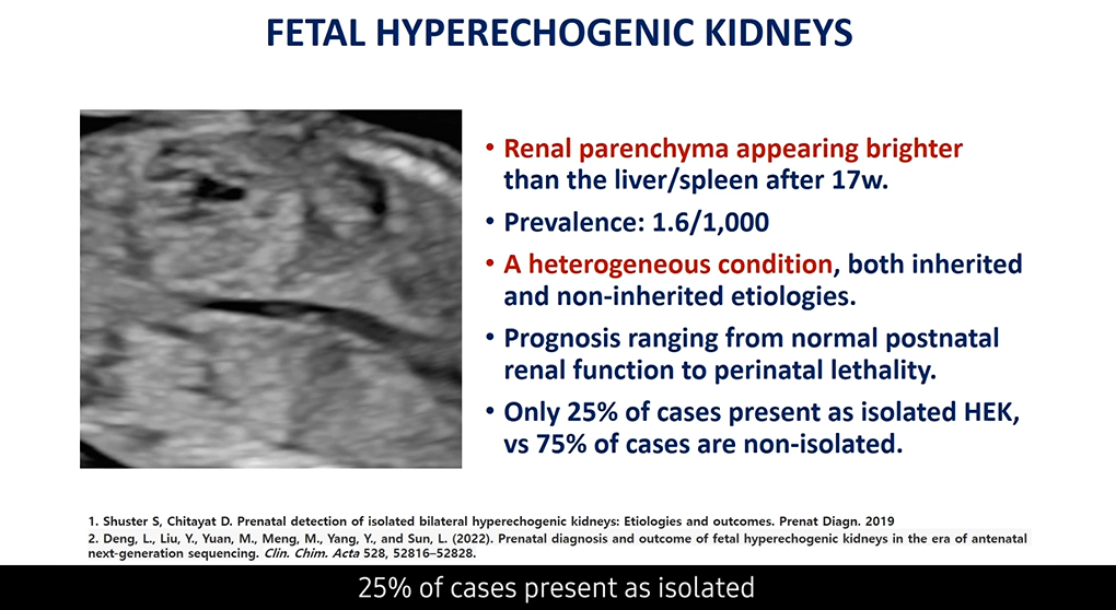 Webinar presentation on hyperechogenic kidney featuring practical prenatal diagnosis approaches and bilateral hyperechogenic kidney evaluation