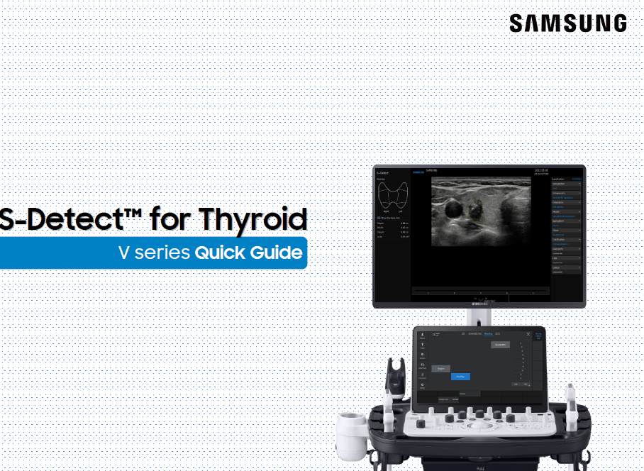 Quick Guide on S-Detect™ for thyroid ultrasound and AI-based nodule detection on Samsung’s V Series ultrasound