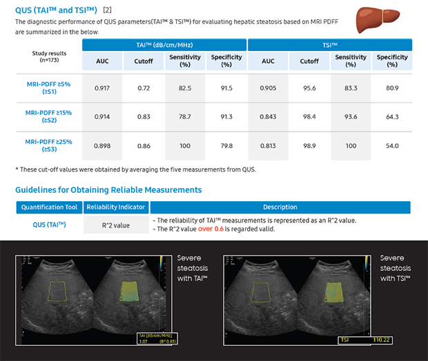 Technical leaflet on RS Series ultrasound QUS tools for liver steatosis & fibrosis (RS85 Prestige, RS85, RS80 EVO)