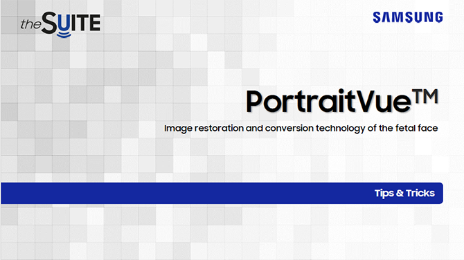 Tips & Tricks on PortraitVue™ for 3D fetal face ultrasound imaging