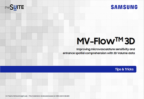 Tips & Tricks on MV-Flow™ 3D for advanced 3D vascular and fetal circulation imaging