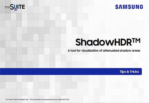 Tips & Tricks on ShadowHDR™ for ultrasound shadow enhancement