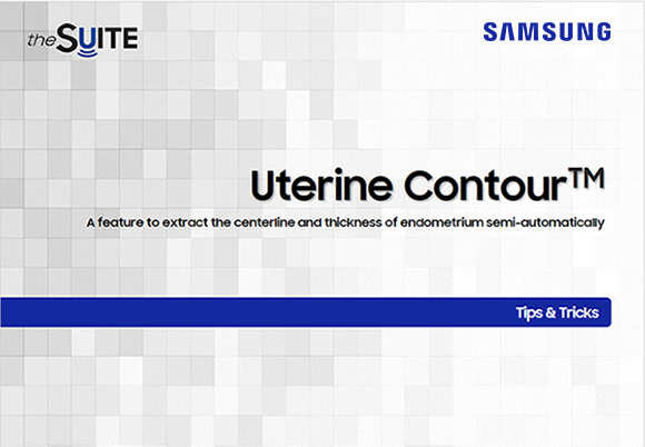 Tips & Tricks on Uterine Contour™ for 3D uterine ultrasound and anomaly classification