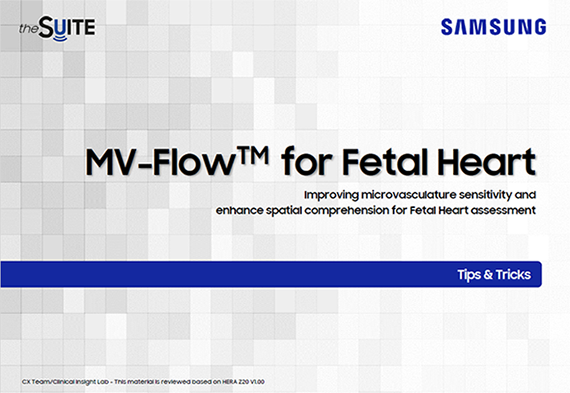 Tips & Tricks on MV-Flow™ for fetal heart microvasculature imaging