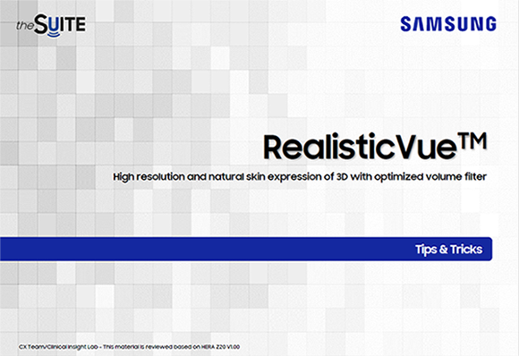 Tips & Tricks on RealisticVue™ for realistic 3D fetal ultrasound imaging