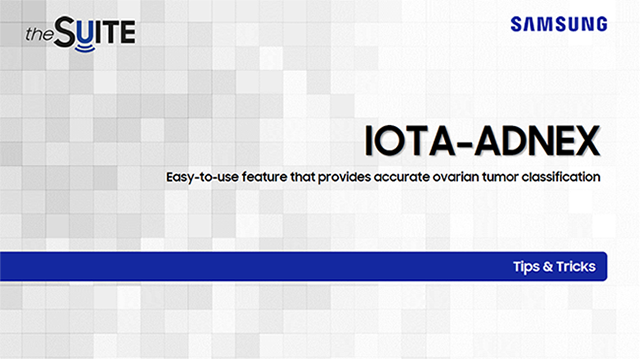 Tips & Tricks on IOTA-ADNEX for ovarian tumor classification and risk prediction