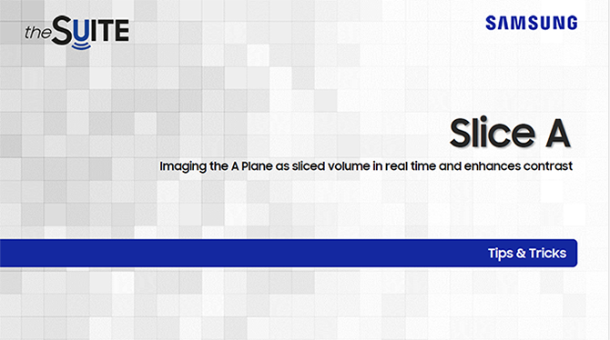 Tips & Tricks on Slice A for real-time A-plane volumetric ultrasound imaging