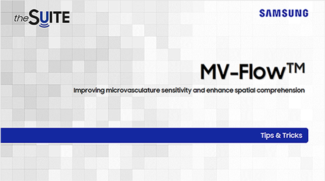 Tips & Tricks on MV-Flow™ technology for microvasculature imaging in fetal brain, abdomen, and placenta using HERA Z20