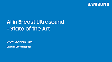 Expert insights on breast ultrasound with AI for cancer detection and lesion assessment
