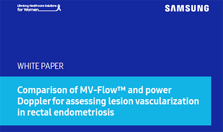 White paper on comparing MV-Flow and power Doppler for vascular assessment in rectal endometriosis.